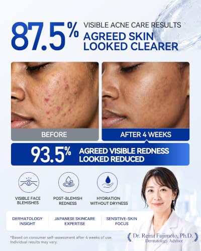 Azelaic Acid Acne Treatment Gel - Gentle Botanical Formula, 1.06 fl oz