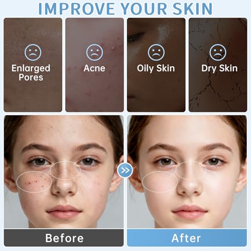 Milk Skincare Set for Girls - Acne Relief & Daily Moisturizing