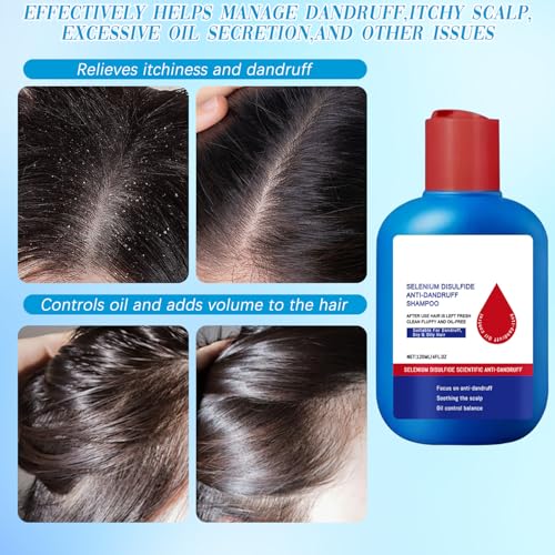 Viuvoiul Nipori Dandruff Shampoo for Men & Women - Oil Control & Scalp Care 120ML