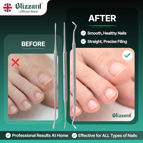 Blizzard 3-Piece Ingrown Toenail Kit - Stainless Steel File & Cleaner Set