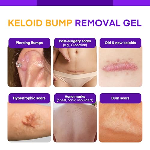 Keloid Bump Removal Gel - Advanced Treatment for Scars & Acne Marks