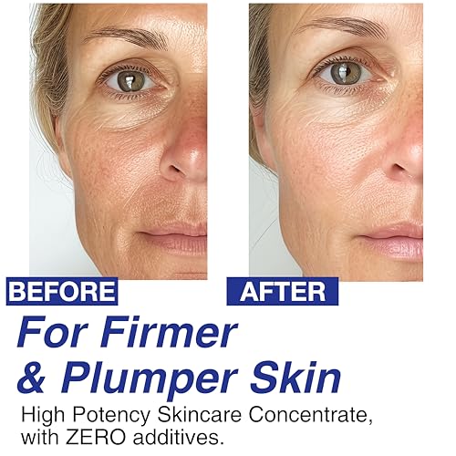 Celdyque 100% Volufiline Concentrate Serum – Face & Jawline Firming Booster