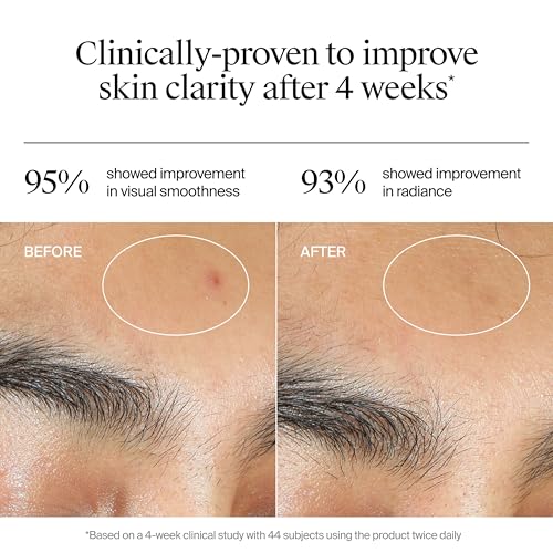Neutrogena Evenly Clear Acne Gel Moisturizer with Salicylic Acid, 1.7 oz