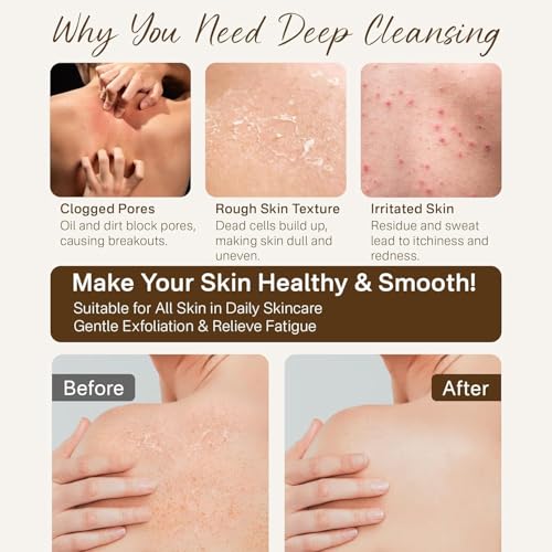 Fundrem 12 Pcs Exfoliating Gloves Set for Smooth Skin