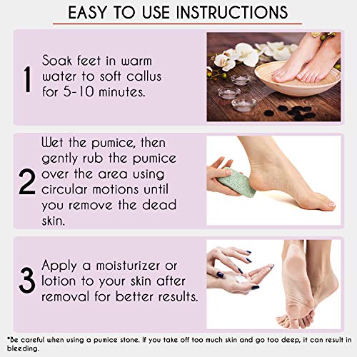 Karlash Double Sided Pedicure Foot Pumice Stone Callus Remover & Scrubber