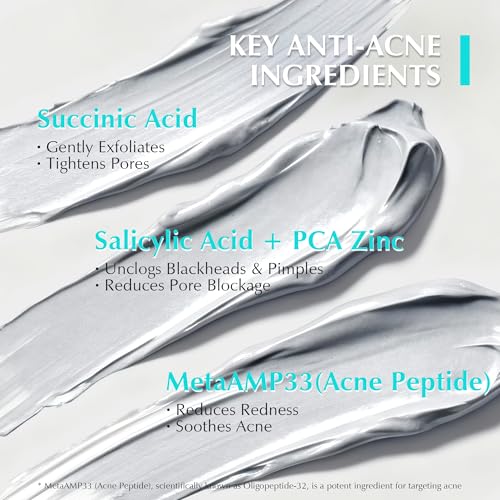 Dead Sea Clay Mask for Deep Cleansing & Acne Control - 4.06 Oz