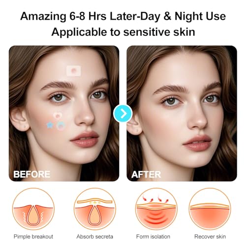 Hydrocolloid Pimple Patches 300 Count with Cute Mirror Case - FUANKANG