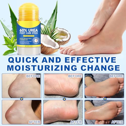 FANSHI Urea Stick 60% - Deep Moisturizing Foot Care for Cracked Heels