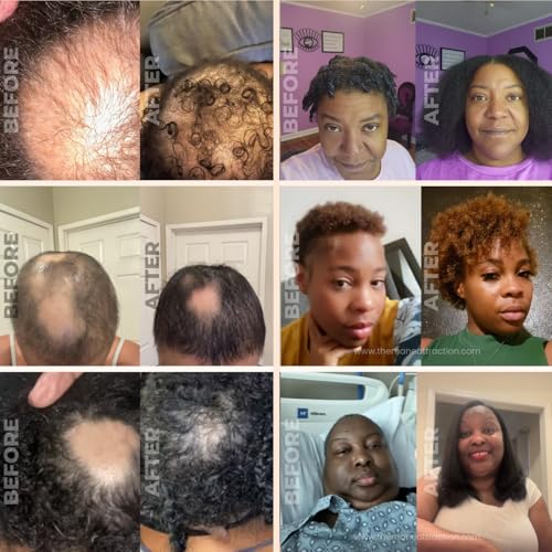 The Mane Attraction Extra-Strength Herbal Hair Growth Oil, Rosemary & Fenugreek Blend, Castor & Vitamin E Infusion, Scalp-Nourishing for All Hair Types