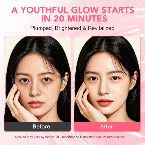 LUCKY CAT PDRN Collagen Eye Patches for Dark Circles & Puffiness (60 Ct)