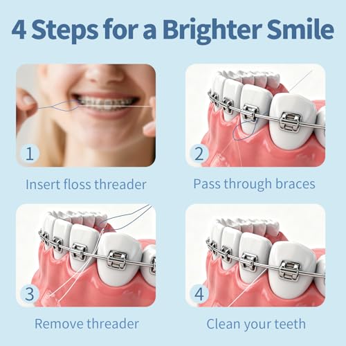 GENKENT 200 Count Dental Floss Threaders for Braces Bridges Implants – Deep Clean (2 Pack)