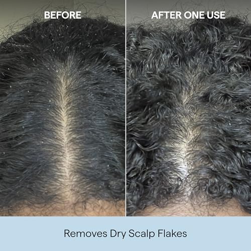 Briogeo Scalp Revival Charcoal + Coconut Oil Micro-Exfoliating Shampoo | Sulfate-Free Scalp Scrub for Dry, Itchy, or Oily Scalp | Detoxifying & Hydrating | Vegan & Cruelty Free