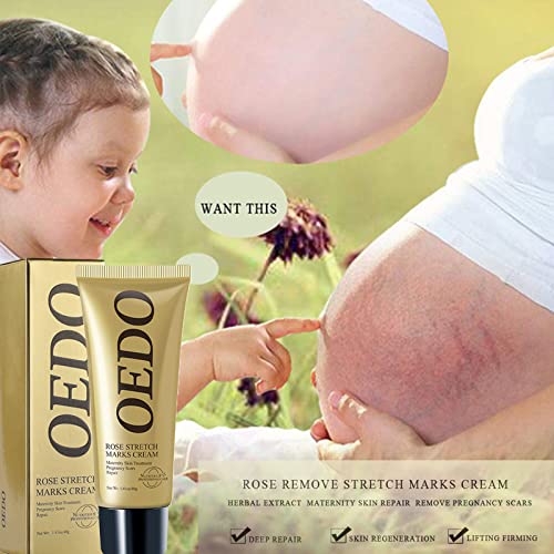Rose Stretch Marks Removal Cream for Pregnancy & Scar Repair - Natural Plant Extracts, 40g