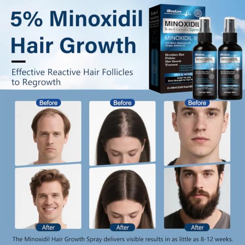 MAYFERTE 5% Minoxidil Hair & Beard Growth Spray - Biotin & Rosemary Serum