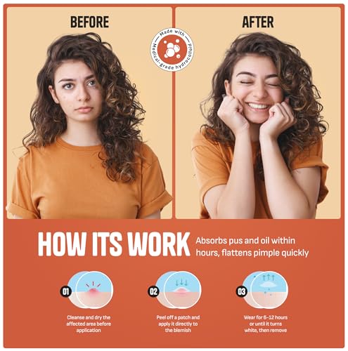 GoGleefy 180 Pimple Patches for Face – Invisible Hydrocolloid Acne Spot Treatment, Day & Night Skin Healing