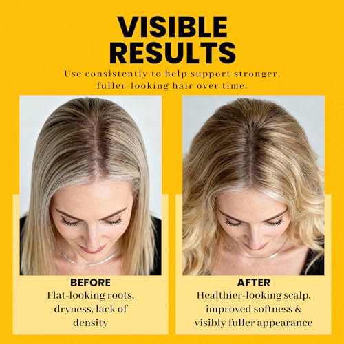 Herbishh Rosemary Hair Essence Oil 50 ml for Thicker, Stronger Hair