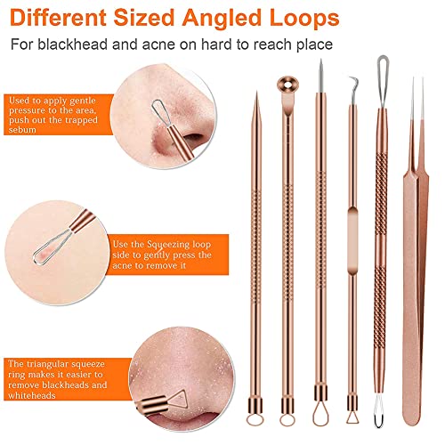 BLAAROOM Rose Gold 6-Piece Pimple Extractor Kit - Blackhead & Acne Removal Tools