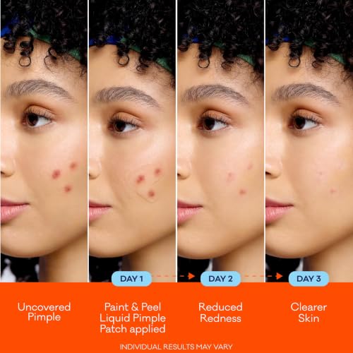 Bioré Paint & Peel Liquid Pimple Patch with Salicylic Acid - 0.5 fl oz (Pack of 1)