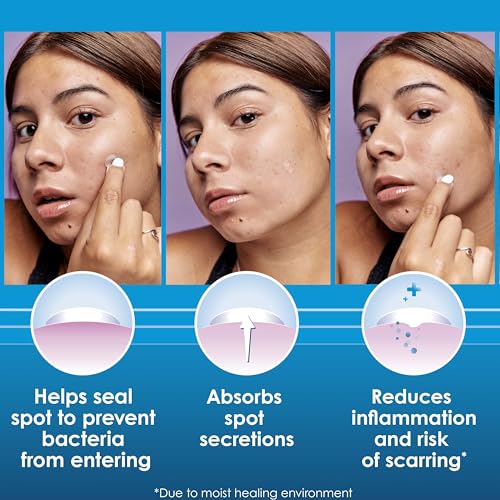 Clearasil Day & Night Acne Spot Patches, 30 Count - Hydrocolloid Treatment