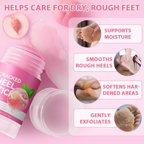 Urea Foot Callus Remover Stick - Moisturizing Heel & Skin Softening Treatment