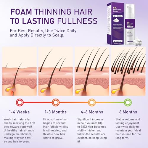 Fugit 5% Minoxidil Foam for Women Hair Growth - Thicker, Fuller Hair, 2 Bottles