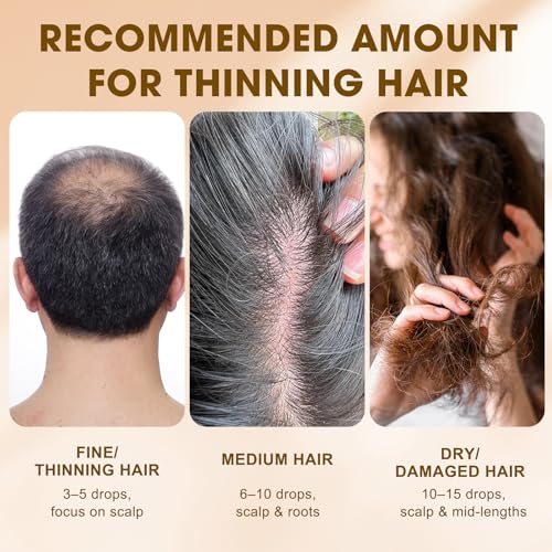 SKSOYT Onion Oil for Hair & Scalp, 2.03 FL OZ - Nourishing Hair Treatment