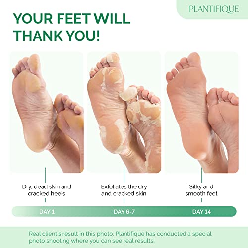 PLANTIFIQUE Peach Foot Peeling Mask - 2 Pairs, Exfoliating for Soft Feet