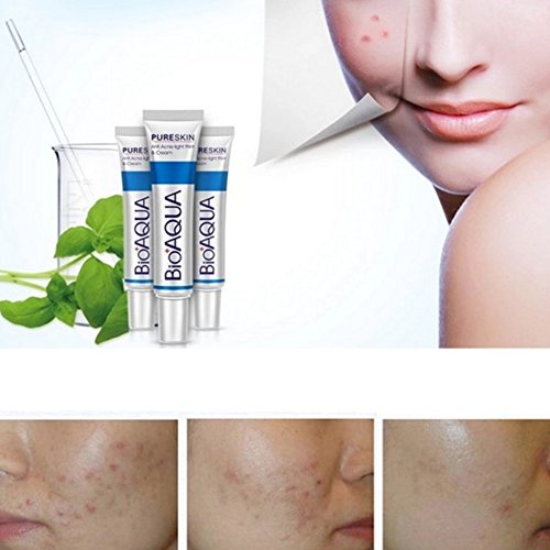 BIOAQUA Acne Scar Repair Cream for Face - Blemish & Mark Treatment