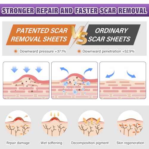 Medical-Grade Silicone Scar Tape for Effective Scar Treatment