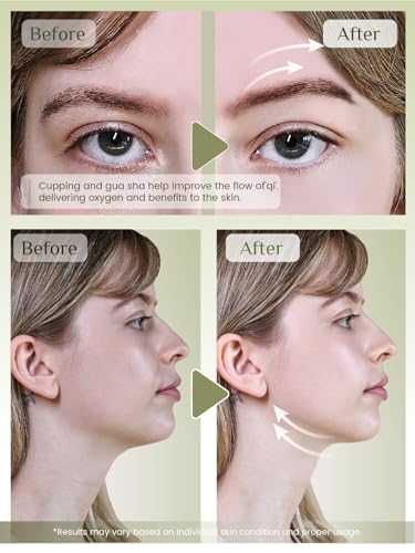 Rena Chris Green Facial Cupping Set & Gua Sha Tool - Jade Therapy for Skin Care