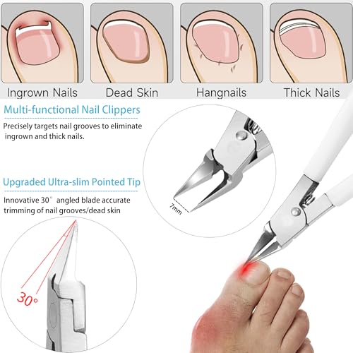 White Mornihima Heavy-Duty Nail Clippers 5-Piece Set for Thick Toenails & Fingernails