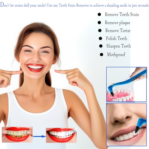 Tooth Stain Remover Kit - 4-Piece Dental Plaque & Tartar Eraser
