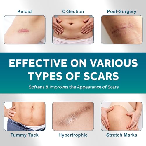 UNIEDI Silicone Scar Sheets - 1.6" x 120" Roll for Surgical & Keloid Scars