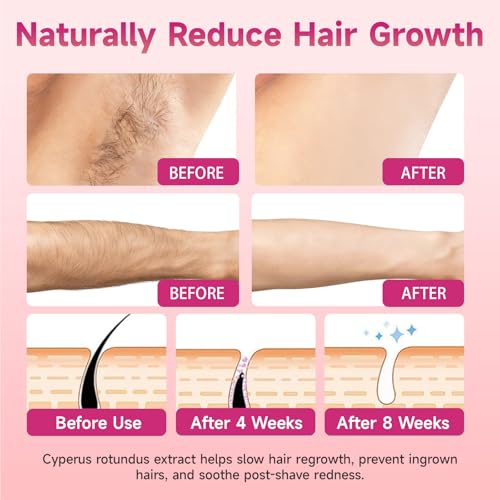 Cyperus Rotundus Oil Serum for Hair Removal & Skin Soothing – Natural 3-in-1 Treatment