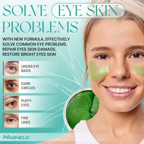 MASHELE Aloe Vera Collagen Under Eye Gel Patches - 60pcs Hydrating Treatment for Dark Circles & Puffiness