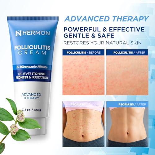 Hermon Folliculitis Cream: Effective for Folliculitis Scalp Face and Body 100g