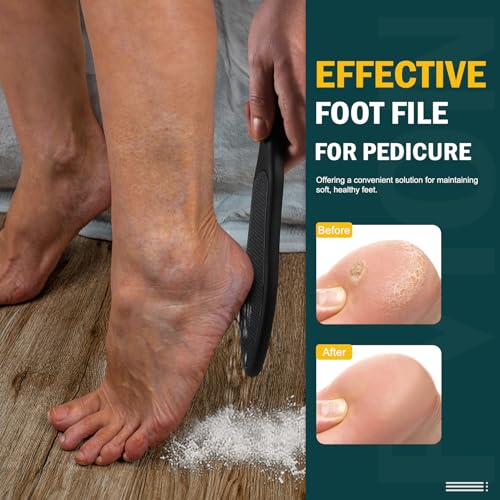 FVION Double-Sided Nano Glass Foot File for Callus Removal - Black