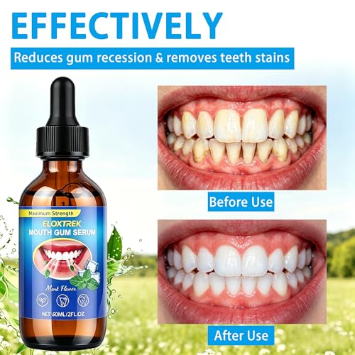 ELOXTREK Gum Restore Drops – Natural Oral Care for Receding Gums, 2 Fl Oz
