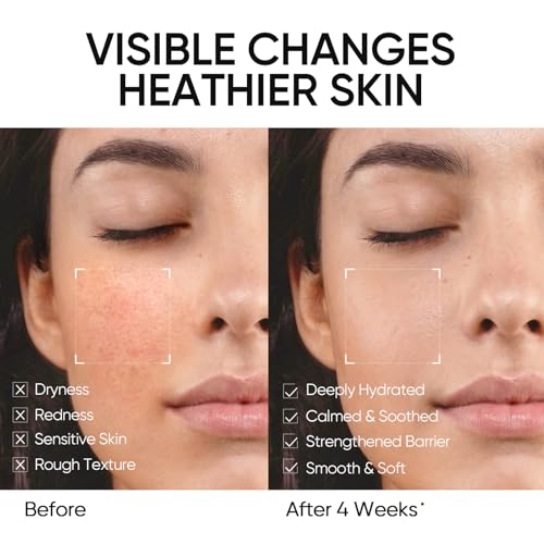 SKINTIFIC 5X Ceramide Barrier Repair Moisturizer - Lightweight Gel for All Skin Types