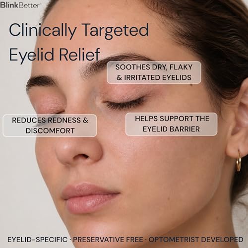 BlinkBetter Restore Eyelid Cream for Dry, Itchy & Sensitive Skin (1 fl oz)