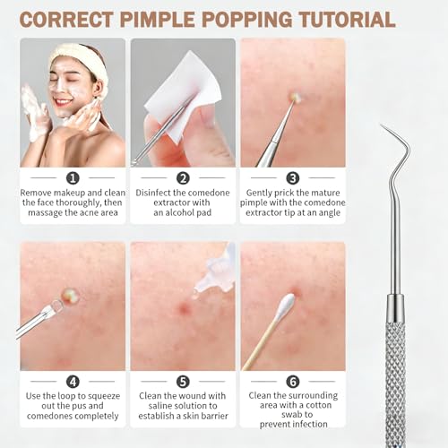 10-Piece Blackhead Remover Tool Kit with Storage Case