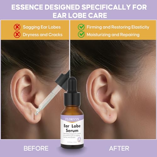 Florvyn Rejuvenating Ear Lobe Serum for Stretched Earlobes