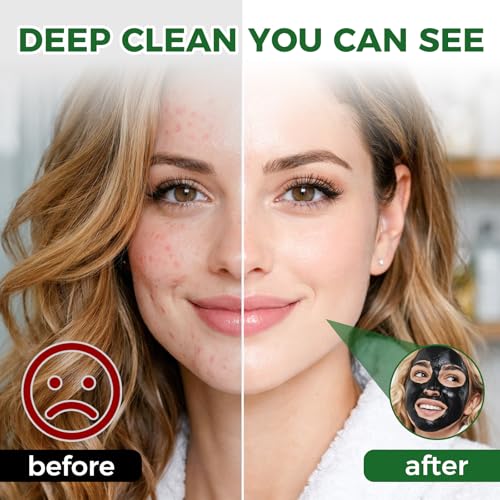 Charcoal Blackhead Remover Mask Set with Silicone Brush