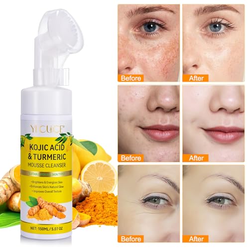 A r b c r n 2 Pack Turmeric Facial Cleanser with Kojic Acid, 150ML - Deep Pore & Skin Firming