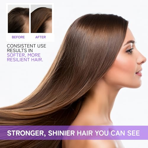 KIT 100Timetros Anti-thinning | AntiQueda FASHION GOLD