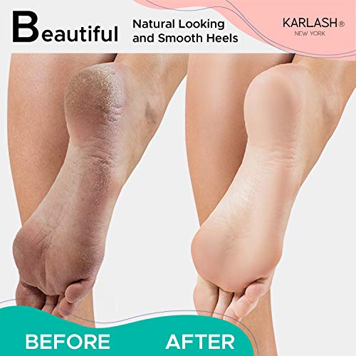 Karlash Double Sided Pedicure Foot Pumice Stone Callus Remover & Scrubber