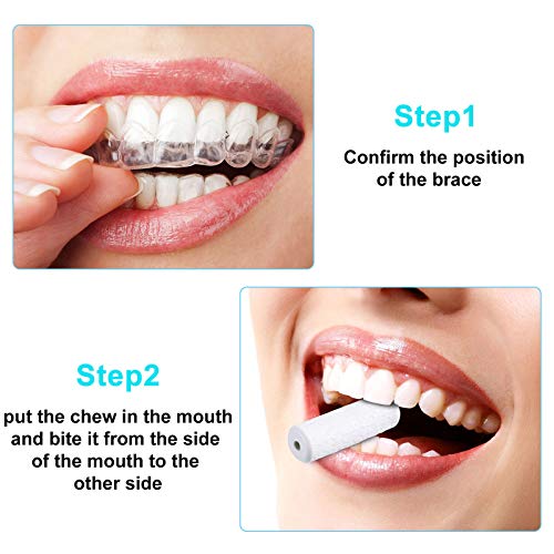 BBTO 60 Pcs Silicone Aligner Tray Seaters for Orthodontic Clear Aligners