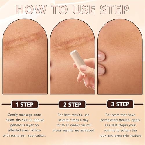 Silicone Scar Stick 2Pcs for Face & Body – Lightweight, Non-Greasy, Twist-Up Roll-On