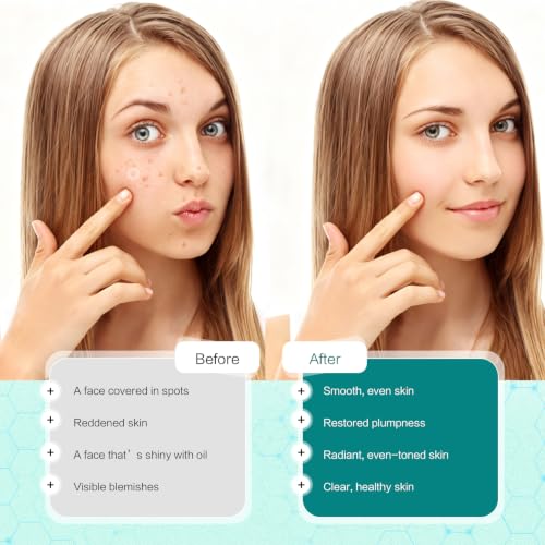 Curalona 2-in-1 Microdart & Hydrocolloid Blemish Patches for Face and Body