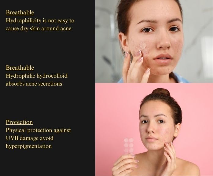 TrustLuxe Glow Hydrocolloid Acne Pimple Patches – Waterproof & Invisible, 36 Count